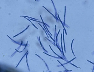 The conidia produced by the pycnidia of <b> <i> Septoria lactucae </i> </b> (septoria, "<i> Septoria </i> leaf spot") are hyaline and threadlike;  they show from 1 to 3 partitions.  Their dimensions are variable: 25-40 x 1.5-2 µm.