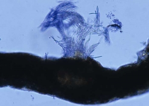 On this leaf in section, we can clearly see a bouquet of thread-like spores gradually emerging from a pycnidia.  <b> <i> Septoria lactucae </i> </b> (septoria, "<i> Septoria </i> leaf spot")