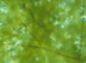 On tissues colonized by <b> <i> Thanatephorus cucumeris </i> </b> (<i> Rhizoctonia solani </i>, "damping-off", "bottom rot"), we sometimes observe, at the Using a binocular magnifying glass, the brown, septate mycelium characteristic of this fungus.
