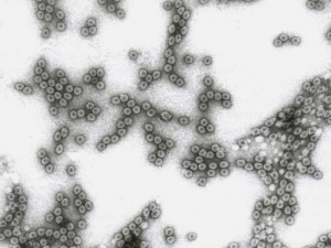 Isometric virus particles approximately 29 nm in diameter.  <b> Cucumber mosaic virus </b> (<i> Cucumber mosaic virus </i>, CMV)