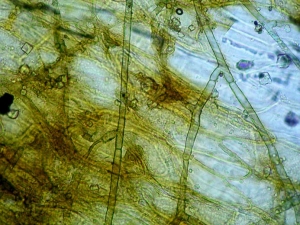 Mycelial filaments running along the surface of the leaf blade of a salad leaf. <b> <i> Thanatephorus cucumeris </i> </b> (<i> Rhizoctonia solani </i>, basal rot, bottom rot)
