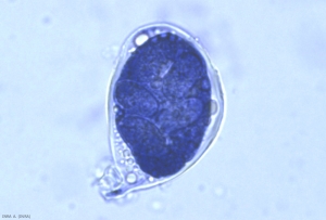 An ascus of <b> <i> Erysiphe necator </i> </b> can contain 2 to 8 ascospores.