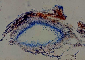 Dentro de este picnuro, podemos ver claramente los muchos conidióforos que lo recubren; los conidios se forman en sus extremos. <b> <i> Phomopsis viticola </i> </b> (excoriosis) 