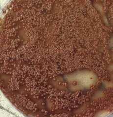 Aspecto en medio nutritivo en placa de Petri de colonias de <b> <i> Elsinoë ampelina </i> </b>, agente de antracnosis en vid.
