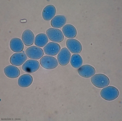 Aspecto de varios esporangios ovoides a piriformes de <b> <i> Plasmopara viticola </i> </b>.