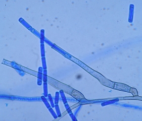 Fialides alargados y endoconidios en cadena de <i> <b> Thielaviopsis basicola </b> </i>.  (podredumbre negra)