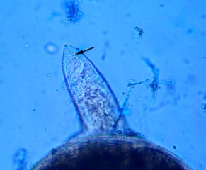<b> <i> Meloidogyne </i> spp. </b>, al igual que otros nematodos fitófagos, tienen un estilete bucal hueco que les permite pinchar las células para absorber el contenido (nematodos agalladores)