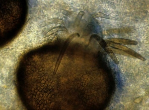 Pycnidus de <b> <i> Pyrenochaeta lycopersici </i> </b>: pardo y globular, presenta varias cerdas pardas y septadas.  (raíces corchosas)