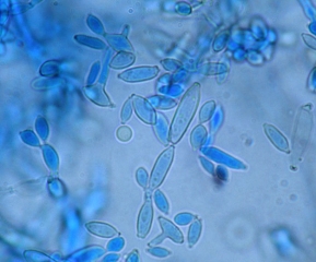 Diversidad morfológica de esporas de <i> <b> Cladosporium cucumerinum </b> </i>.  (cladospriosis)