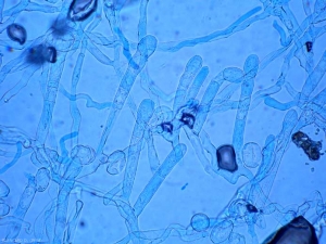 Se erigen varios conidióforos en el micelio.  Se han formado uno o unos pocos conidios en sus extremos.  <i> <b> Podosphaera xanthi </b> </i> o <b> <i> Golovinomyces cichoracearum </i> var.  <i> cichoracearum </i> </b> (Oidio).