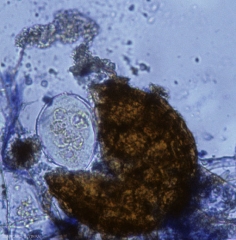 Exprimiendo este cleistotecio de <i> Podosphaera xanthii </i> </b>, fue posible extraer un ascus que contenía 8 ascosporas.  (oidio).