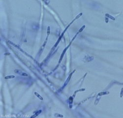 Fialides delgados, ligeramente hinchados en la base, producen conidios hialinos.  Forma anamórfica = <i> Plectosporium tabacinum </i> / <b> <i> Monographella cucumerina </b> </i>