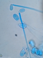 Se forma un conidio joven de <i> <b> Trichothecium roseum </b> </i> en la punta de un conidióforo. 