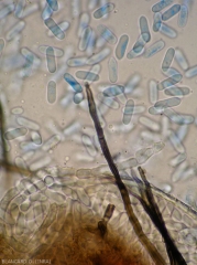 Detalle de una tarde negra dividida y conidios hialinos de <i> Colletotrichum </i> sp.