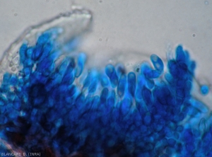 Formación de numerosos conidios dentro de un acérvulo observado en sección bajo un microscopio óptico.  .  <i> Colletotrichum </i> sp. 