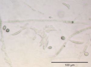 <b><i> Fusarium oxysporum </i> f.  sp.  <i> melongenae </i></b> forma macro y microconidios, así como clamidosporas que aseguran su difusión y conservación.