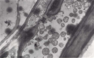 Varias estructuras más o menos esféricas caracterizan la presencia del fitoplasma en los vasos del floema.  <b> <i> Candidatus </i> Phytoplasma solani </b> (grupo de amarillos aster)