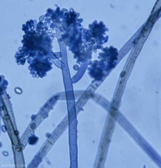 <i> <b> Botrytis cinerea </b> </i> desprende conidióforos fuertes y largos, irregularmente ramificados, gradualmente melanizados en la base (moho gris, moho gris)