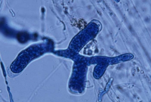 Esporangio filamentoso hinchado <b><i>Pythium aphanidermatum</i></b> ("damping-off")