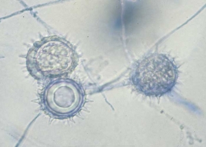 Oogonia adornado con <b><i>Pythium</i> sp.</b> ("damping-off")