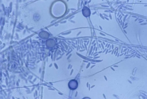 <b> <i> Fusarium oxysporum </i> f. sp. <i> lactucae </i> </b> ("marchitez por fusarium") produce microconidios unicelulares y macroconidios "en forma de media luna" con un máximo de 3 a 4 particiones. También forma clamidosporas de paredes gruesas, intercalares o terminales y aisladas o en cadenas. 