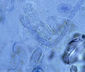 <b> <i> Golovinomyces cichoracearum </i> var. <i> cichoracearum </i> </b> (mildiú polvoriento) en su forma imperfecta comúnmente produce cadenas de conidios hialinos, cilíndricos a doliformes (25-45 x 14-26 µm), localizados al final de conidióforos cortos.