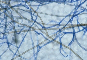 <b> <i> Thanatephorus cucumeris </i> </b> (<i> Rhizoctonia solani </i>) se caracteriza por un micelio marrón, tabicado y constreñido en la base de las ramificaciones.