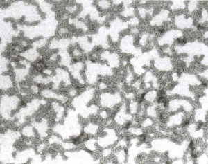 Partículas de virus baciliforme poliédrico de 18 nm de diámetro. <b><i>Alfafa mosaic virus</i></b>, AMV.