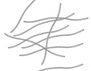 Partículas virales flexibles de 15 nm de diámetro y aproximadamente 750 nm de largo (tipo potyvirus). <b><i>Endive necrotic mosaic virus</i></b>, (ENMV).