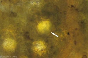 Se pueden observar oosporas de paredes gruesas (20-120 µm de diámetro) de <i><b> Plasmopara viticola</b> </i> en tejidos contaminados al final de la temporada.  Son de color amarillo y representan la reproducción sexual del <b> mildiú de la vid </b>.