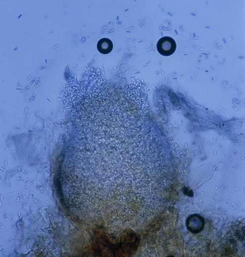 Cette jeune pycnide de <i><b>Didymella lycopersici</b></i>, subglobuleuse à allongée, va progressivement se mélaniser (100 à 270 µm de diamètre). On distingue tout autour de nombreuses conidies. Ajoutons que ce champignon peut former des périthèces (120-150 x 100 µm) à l'origine d'ascospores bicellulaires (16-18 x 5-6,5 µm). <b>Chancre à <i>Didymella</i> (<i>Didymella</i> stem canker and fruit rot)</b>