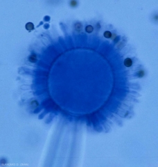 C'est sur cette vésicule typique du genre <i>Aspergillus</i>, que sont situées les phyalides, qui couvrent la totalité de sa surface (radiale)<b><i>Aspergillus</i> sp.</b> (pourriture à Aspergillus)