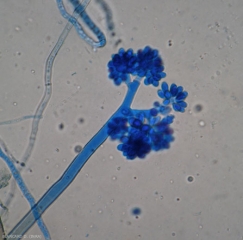 Jeune conidiophore ramifié de <i><b>Botrytis cinerea </b></i> observé au microscope photonique. (pourriture grise).