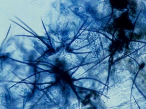 Les microsclérotes sont hérissés de soies noires (setae) ; celles-ci, présentent à l'intérieur des acervules, permettant de caractériser le genre <i>Colletotrichum</i>. <i><b>Colletotrichum coccodes</b></i>