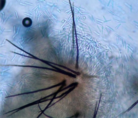 Les acervules de <i><b>Colletotrichum orbiculare</b></i> forment de très nombreuses conidies hyalines, unicellulaires, oblongues à ovoïdes, mesurant 4-6 x 13-19 µm. (anthracnose)