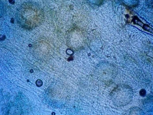 Plusieurs jeunes fructifications en cours de développement sont visibles au microscope photonique dans des tissus lésés. <i><b>Didymella bryoniae</b></i> 