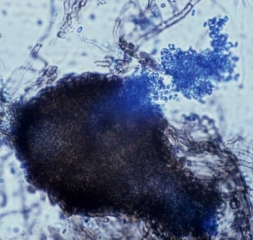 Aspect au microscope photonique d'une pycnide de <i><b>Didymella bryoniae</b></i> ; des conidies sont en train d'être libérées.