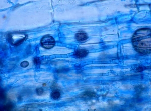 Aspect au microscope photonique du mycélium cloisonné et mélanisé de <i><b>Macrophomina phaseolina</b></i> se développant sur ou dans des tissus végétaux.