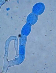 Trois conidies en courte chaîne se sont formées à l'extrémité d'un court conidiophore de <i><b>Podosphaera xanthii</b></i>. (oïdium)