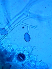 <i><b>Pseudoperonospora cubensis</b></i> (mildiou, downy mildiou) sur concombre