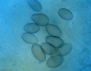 Plusieurs sporanges plus ou moins mélanisés sont visibles sur ce limbe observé au microscope photonique. <i><b>Pseudoperonospora cubensis</b></i>  (mildiou)