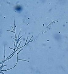 <i><b>Verticillium dahliae</b></i> forme des conidiophores verticilliés, hyalins et cloisonnés portant à chaque noeud 3 ou 4 <b>phialides</b> verticilliés (16-35 x 1-2,5 µm) et des <b>conidies</b> hyalines, ovoïdes, unicellulaires, mesurant 2,5-8 x 1,4-3,2 µm.  (Verticilliose)