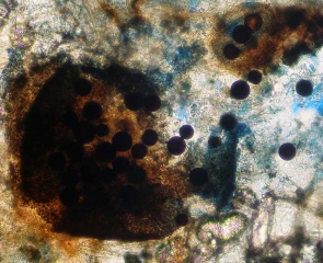 Perithèce éclaté ayant libéré des ascospores brun sombre à noires. <i><b>Monosporascus </i> sp. </b>