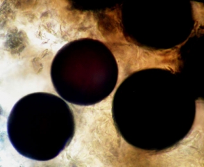 Aspect de quelques ascospores matures dont la teinte varie du brun sombre au noir. <i><b>Monosporascus</i> sp. </b>