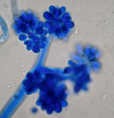 Les conidiophores de <i><b>Botrytis cinerea</b></i> sont arbusculeux et produisent des spores hyalines et ovoïdes.  (moisissure grise)