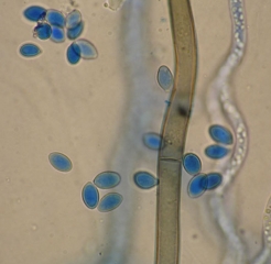 Conidies ovoïdes, hyalines à légèrement brunâtres de <i><b>Botrytis cinerea</b></i> . Du mycélium cloisonné est également visible. (pourriture grise)
