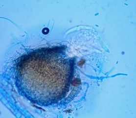 Aspect d'un périthèce de <b><i>Didymella bryoniae</i></b>, après l'avoir pressé, des asques immatures s'en échappent. (forme téléomorphe)(pourriture noire, black rot)