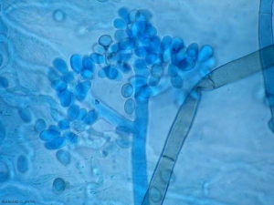 B.cinerea-Conidiophore2.jpg