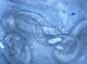 Oeuf de <b><i>Meloidogyne</i></b> sp. ("root-knot nematodes") renfermant une jeune larve au stylet bien visible.