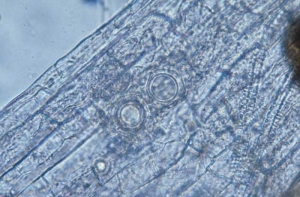 Des oospores rondes, à paroi épaisse, sont présentes sur ou dans les tissus racinaires ; elles matérialisent fréquemment le parasitisme des <b><i>Pythium</i> spp.</b> ("damping-off"). 